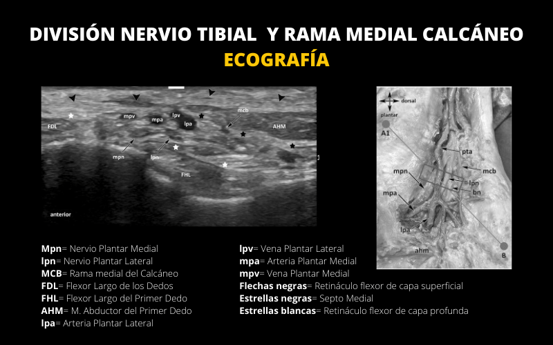 Tibial y Calcaneo.png